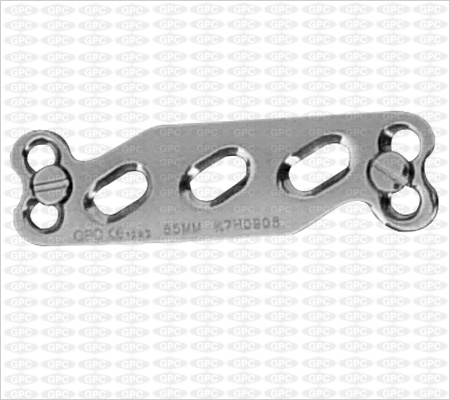 Anterior Cervical Plate (Z-Plate)