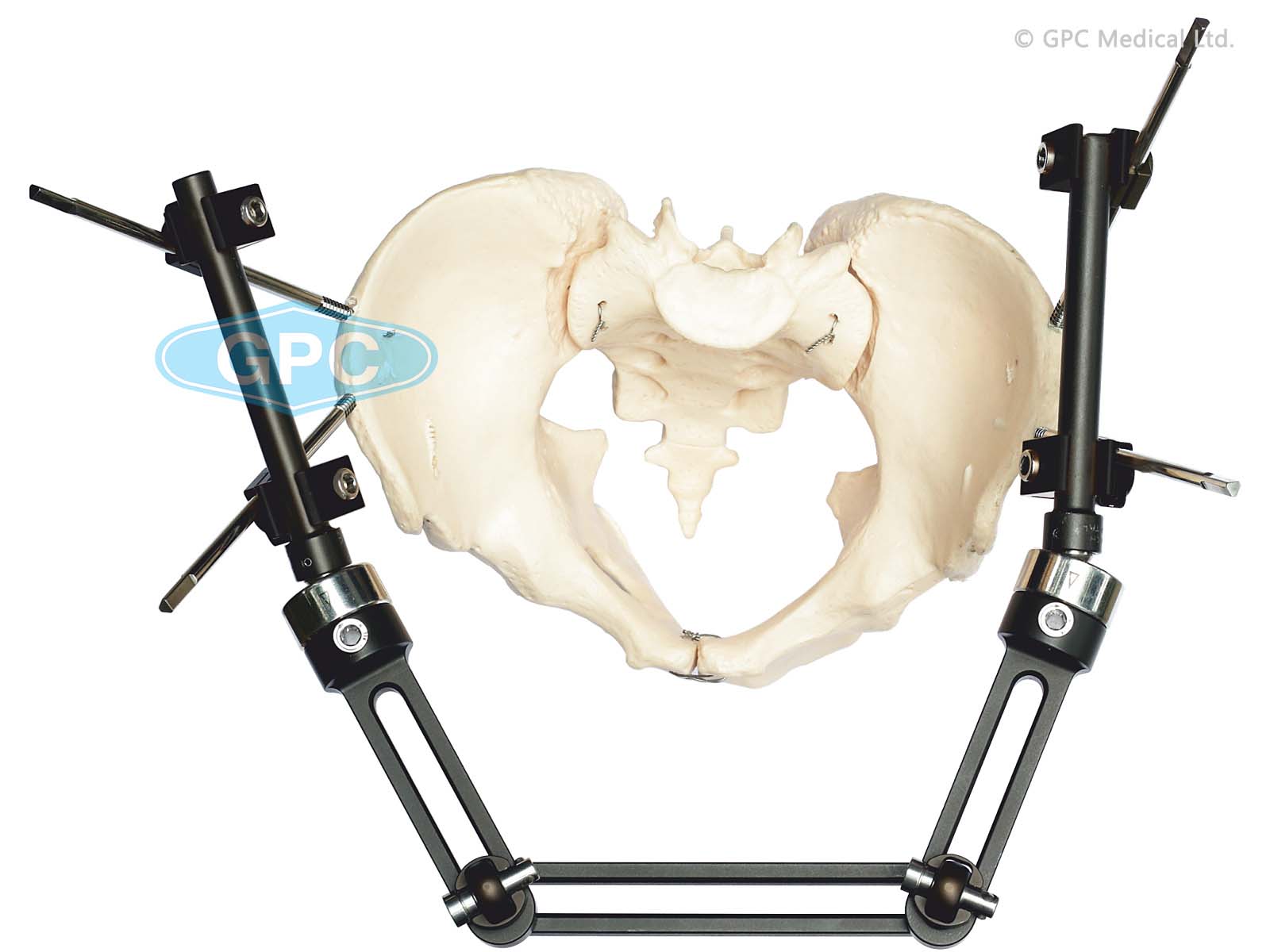 ex<em>HEAL</em> Pelvic Fixator System