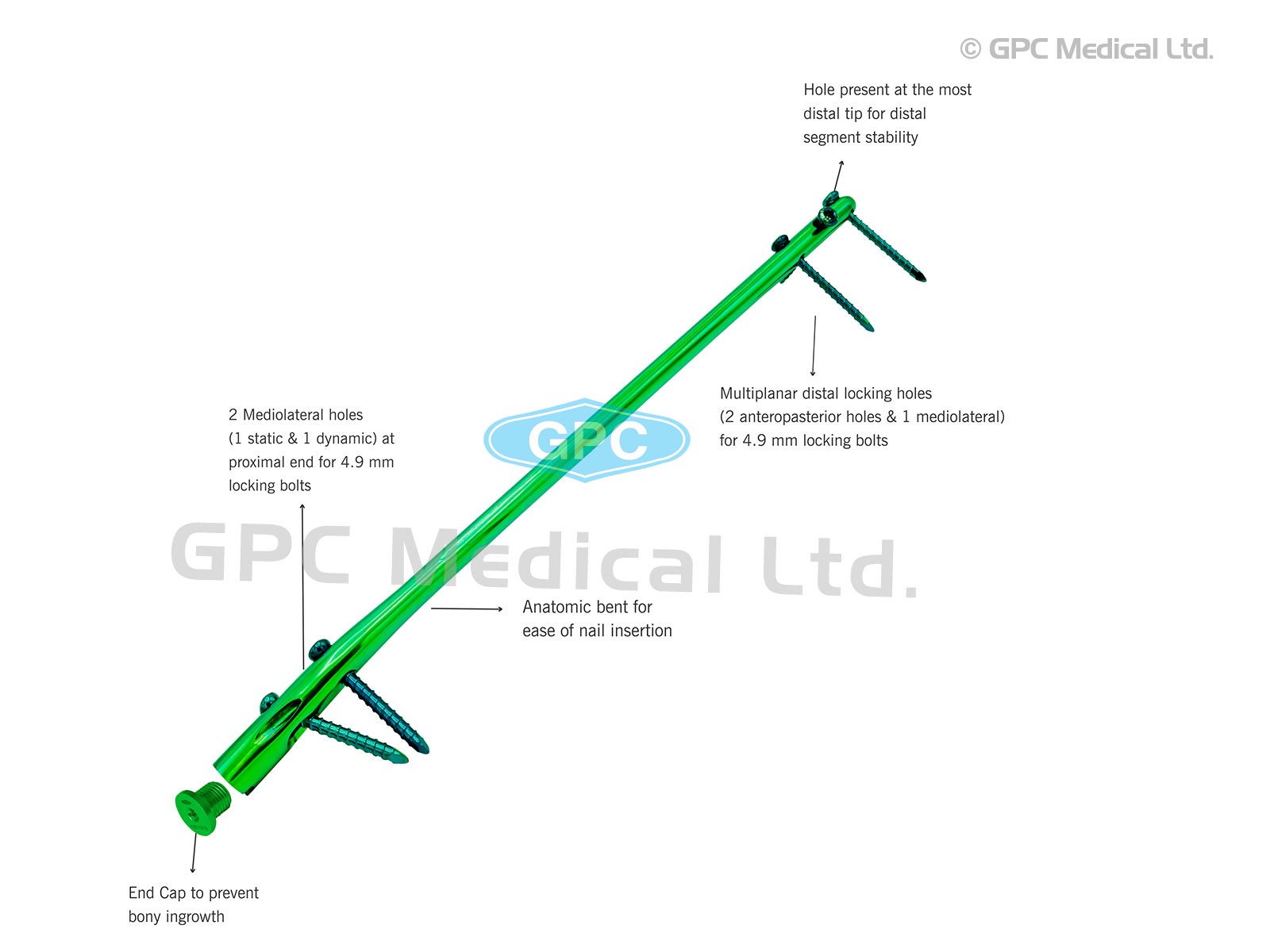 intra<em>HEAL</em> Reamed Tibial Nail, Distal Tip